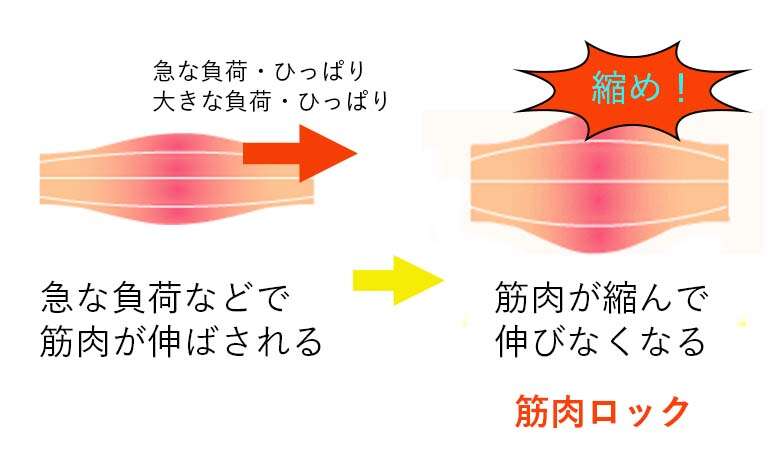 急な負荷と筋肉のロック