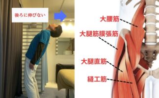 体を後ろに反らせると痛い腰痛の原因